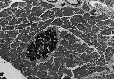 Slika 4 Pankreas (SM - viktorija-plavo) Na mikrografiji je prikazan deo tkiva pankreasa sa Langerhansovim ostrvcem.
