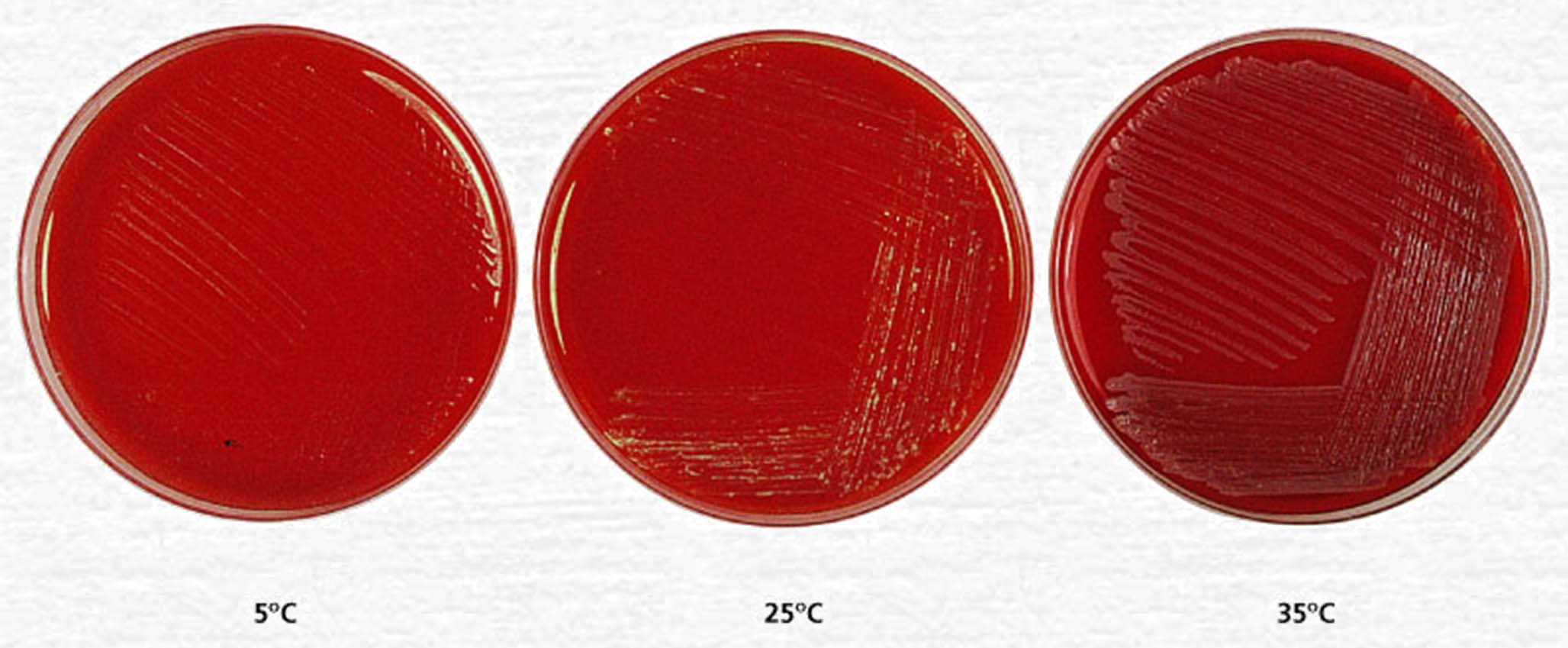 Effects of Temperature on Growth Growth of Staphylococcus aureus