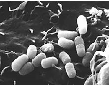 E. coli Gram: (-) Mac Conkey: βιολετί Αιματούχο: λευκές Αντοχή: Ίσως: Ampicillin (AM), Pipperacillin (PIP), Septrin (SXT), Cephalothin (CF) P-ινίδια: στελέχη E.