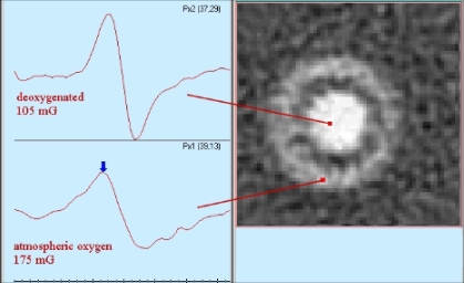 Οξυμετρία: «spatial mapping» της συγκέντρωσης Ο 2 3D EPR image δύο ομόκεντων δοκιμαστικών με το ίδιο