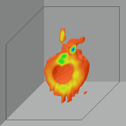 3D Image καρδίας ποντικιού με glucose char A C PA B Ao Ao LAD LM LV LV apex LV apex 3D EPR image ισχαιμικής καρδίας ποντικιού εμποτισμένη με glucose char (oximetry label).