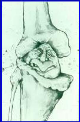 ΠΟΝΟ Patient s arthritis pain VAS ΤΝΟΛΗΚΖ ΔΚΣΗΜΖΖ ΣΖ ΔΝΔΡΓΟΣΖΣΑ ΣΖ ΝΟΟΤ ΑΠΟ ΣΟΝ ΑΘΔΝΖ Patient s global assesment of disease activity PtGA KOΠΩΖ Fatigue