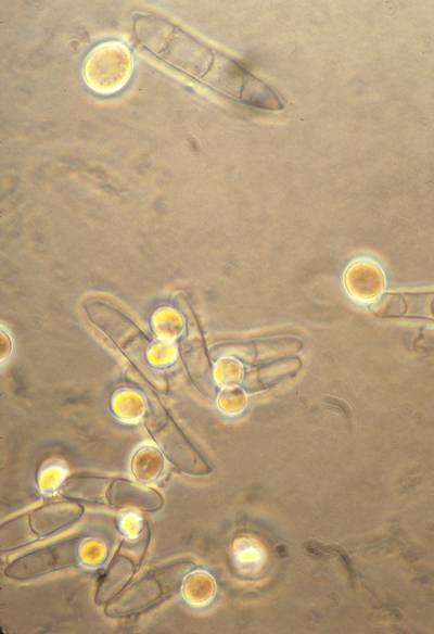 Fusarium oxysporum (2) Κονίδια Χλαμυδοσπόρια Πηγή: http://thunderhouse4- yuri.