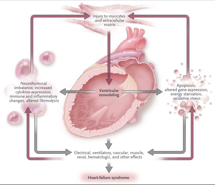 Παθοφυσιολογία της συστολικής καρδιακής ανεπάρκεια Οι δυσπροσαρμοστικές διαταραχές που συμβαίνουν στα μυοκύτταρα που έχουν επιβιώσει και στην εξωκυττάρια θεμέλια ουσία (extracellular matrix) μετά την
