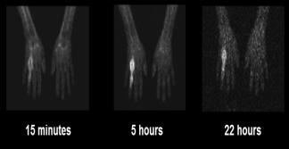 Certolizumab, Fc-free, PEGylated Anti-TNF Cimzia Structure Fab PEG Cimzia Feature Only PEGylated anti-tnf Observed effects Clinical Hypothesis Ongoing research Increased half life (14 days) and