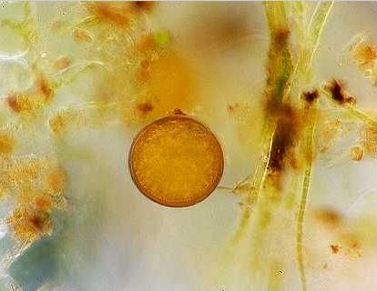 Νήματα Spirogyra με ζυγώτες Ζυγοσπόριο