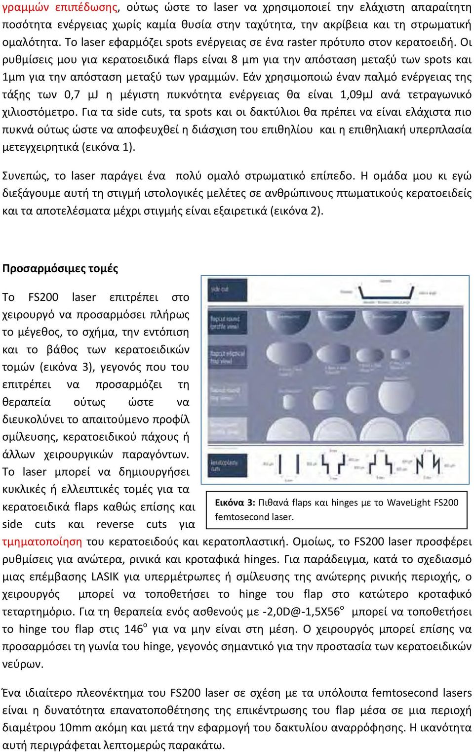 Οι ρυθμίσεις μου για κερατοειδικά flaps είναι 8 μm για την απόσταση μεταξύ των spots και 1μm για την απόσταση μεταξύ των γραμμών.