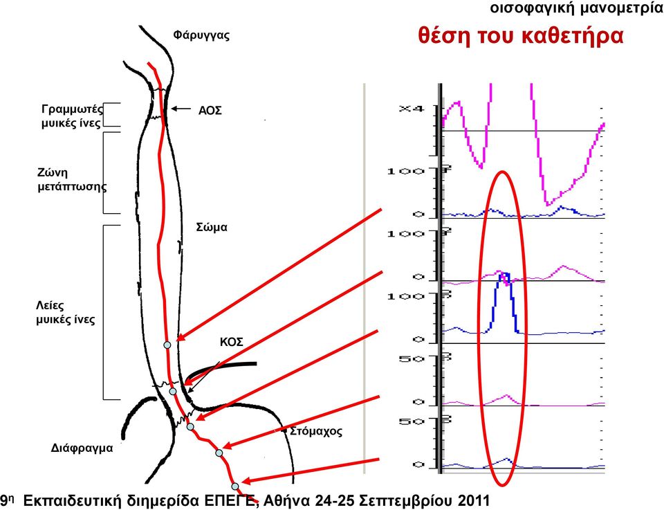 Λείεο κπηθέο ίλεο ΚΟΣ Δηάθξαγκα Σηόκαρνο 9 ε