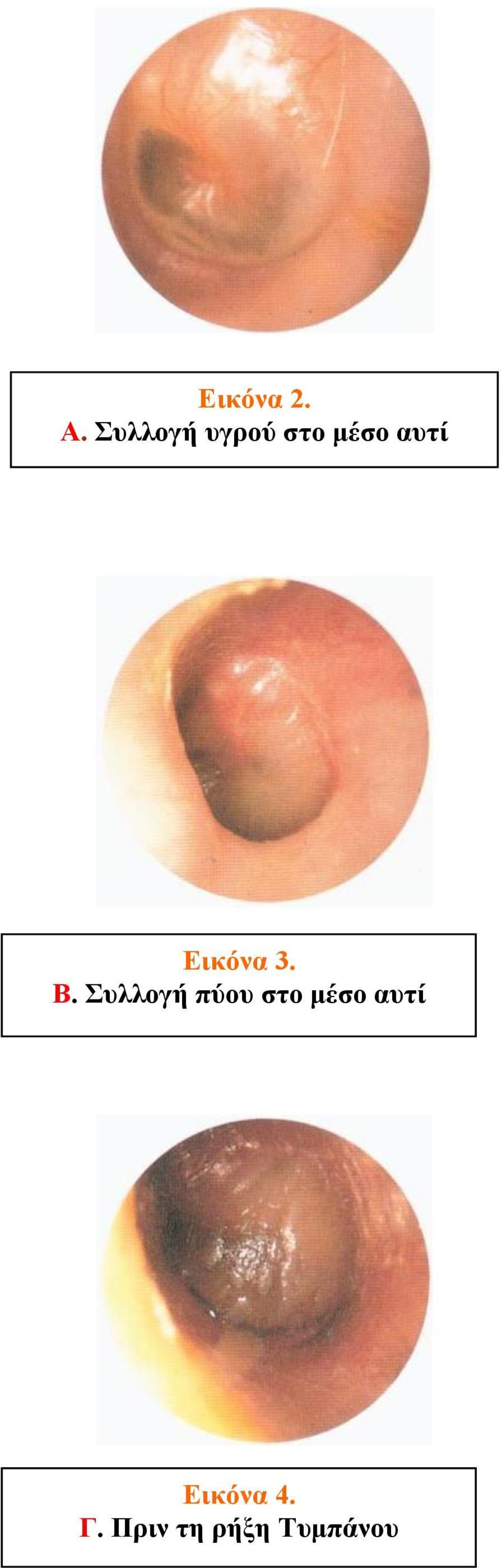 Εικόνα 3. Β.