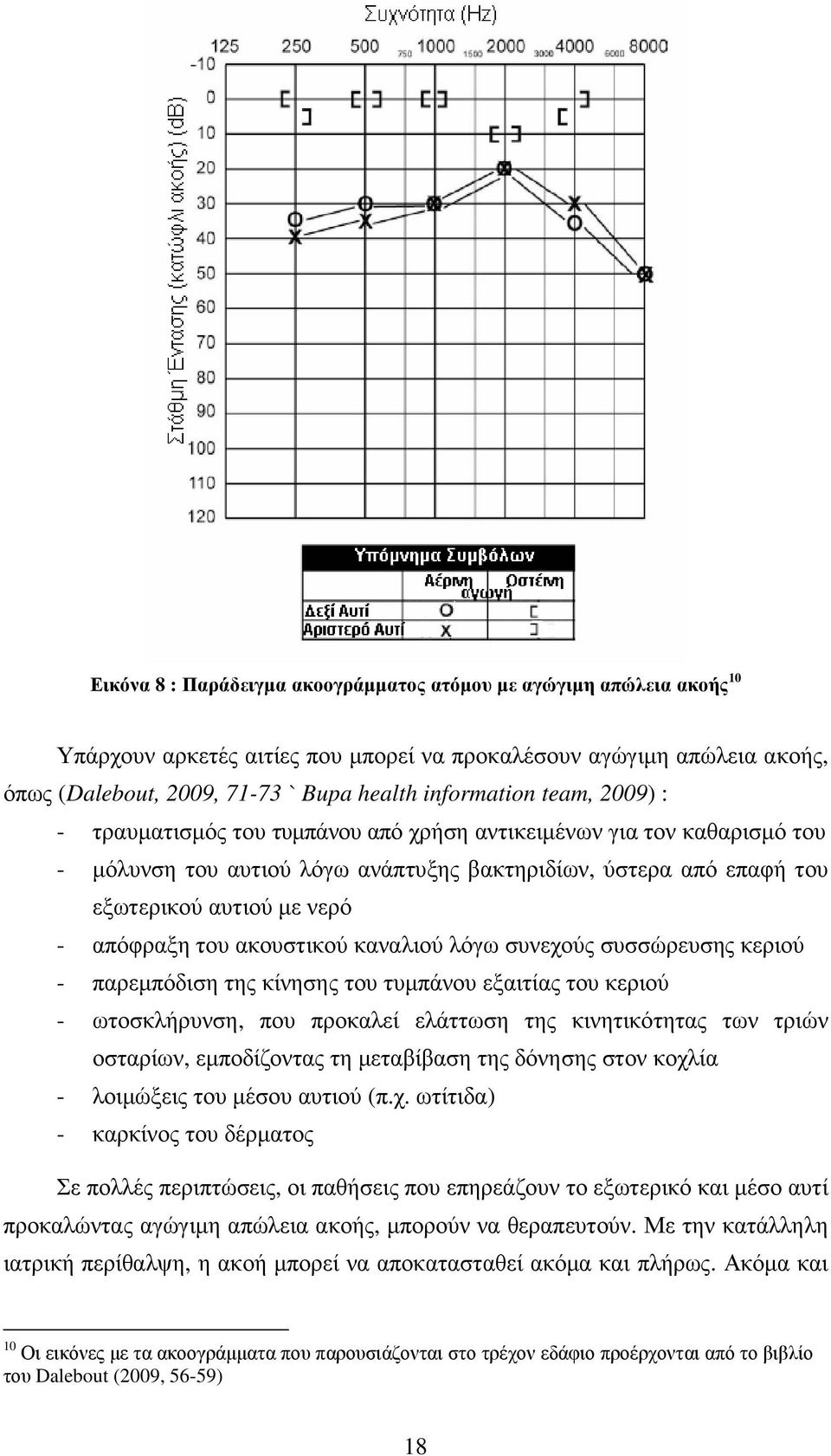 ακουστικού καναλιού λόγω συνεχούς συσσώρευσης κεριού - παρεµπόδιση της κίνησης του τυµπάνου εξαιτίας του κεριού - ωτοσκλήρυνση, που προκαλεί ελάττωση της κινητικότητας των τριών οσταρίων,