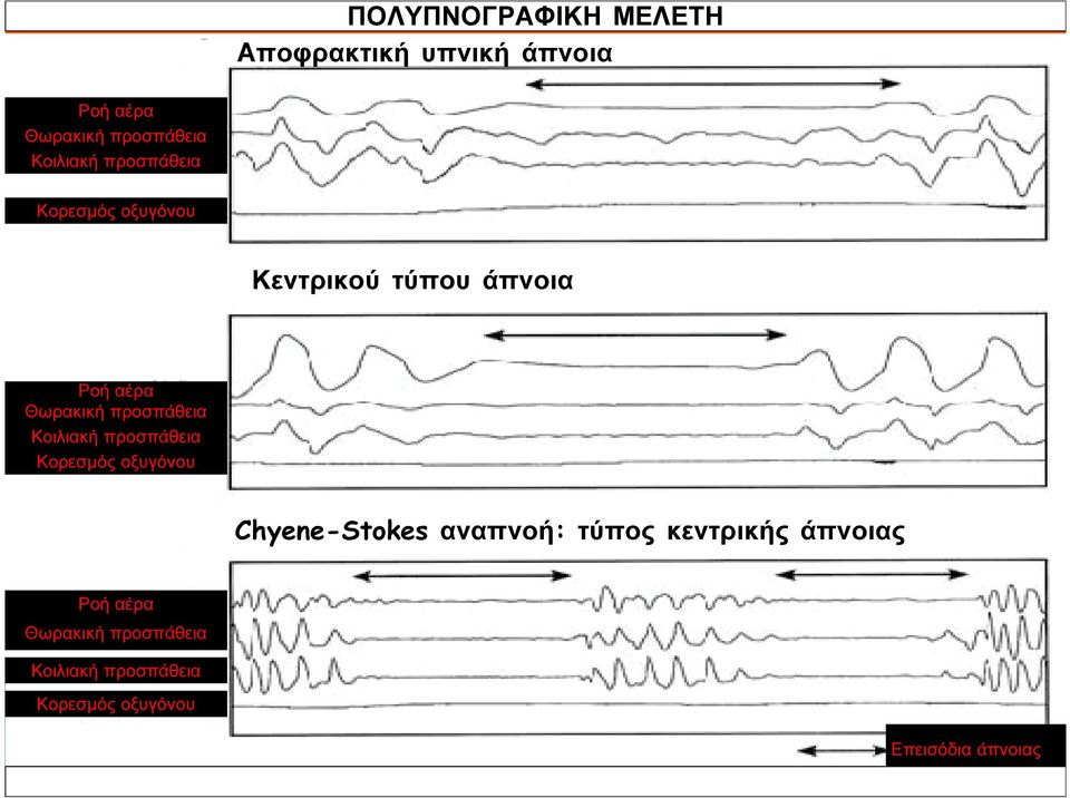 προσπάθεια Κοιλιακή προσπάθεια Κορεσµός οξυγόνου Chyene-Stokes αναπνοή: τύπος