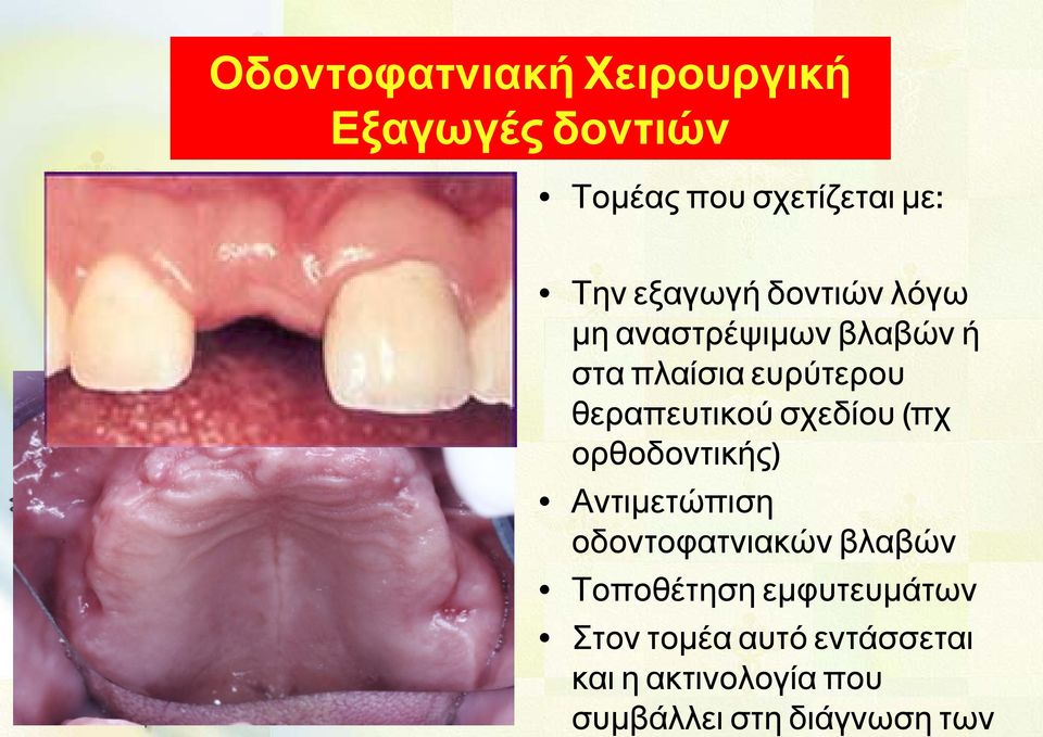 θεραπευτικού σχεδίου (πχ ορθοδοντικής) Αντιμετώπιση οδοντοφατνιακών βλαβών