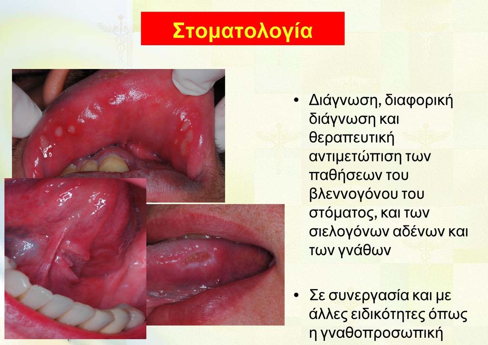 του στόματος, και των σιελογόνων αδένων και των