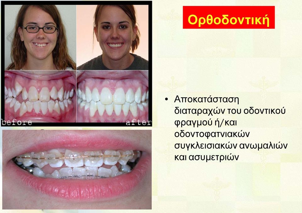 φραγμού ή/και οδοντοφατνιακών