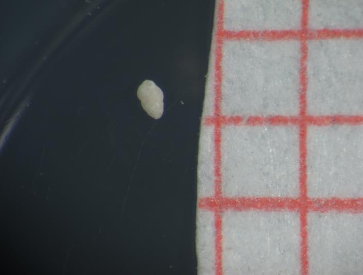 13) Neoconorbina terquemi, οπίσθια όψη 14)