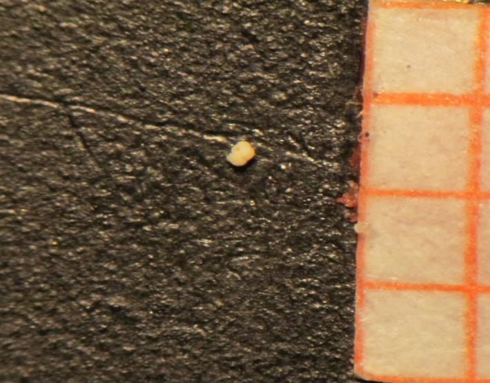16) G.bulloides, ραχιαία όψη 17) G.