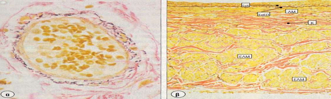 Μικρή και μεγάλη φλέβα Εικ. α: Μικρή φλέβα. Χρώση: Van Gieson, (λείος μυς: κίτρινος, κολλαγόνο: κόκκινο, ελαστικές ίνες: μαύρες). Εικ. β: Κάτω κοίλη φλέβα.