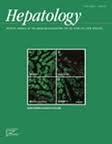 Ηπατική Ανεπάρκεια (θεραπεία) - Liver transplantation is the only therapy of proven benefit ( but the rapidity of progression and the