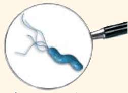Helicobacter pylori - vysoké
