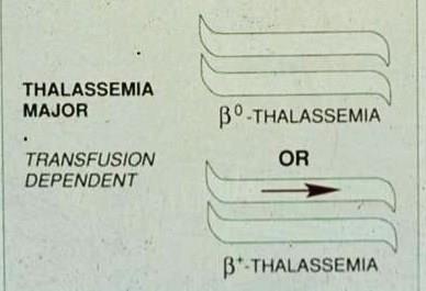 β-θαλασσαιμία Κυρίως σημειακές μεταλλαγές Φορείς: ήπια αύξηση της HbA 2 και HbF Νόσος του