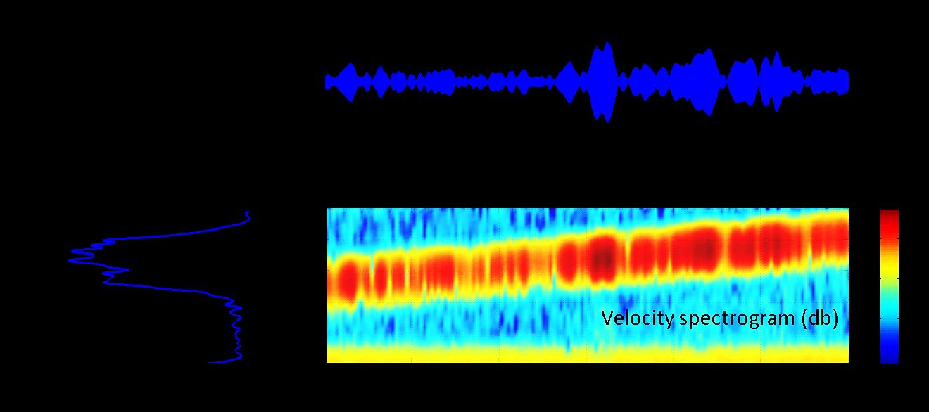 5. Δονησιομετρία Σάρωσης με Laser - LSV (Laser Scanning Vibrmetry) Μέθοδος LSV Αρχή Λειτουργίας Ανάλυση Furier