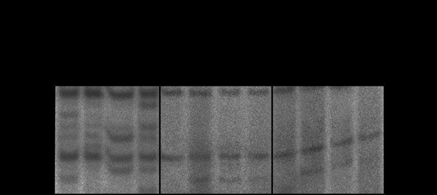 CMCT CMCT KE Εικόνα 10.3: Προστασία έναντι χημικών τροποποιητών νουκλεοτιδίων της κεντρικής θηλιάς της περιοχής V του 23S rrna που προκαλείται από πρόσδεση του ΚΑ240 και του F5, στο ριβόσωμα.