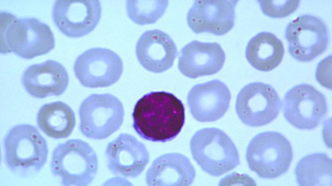 Blood lymphocyte T cell or B cell, antigen-specific