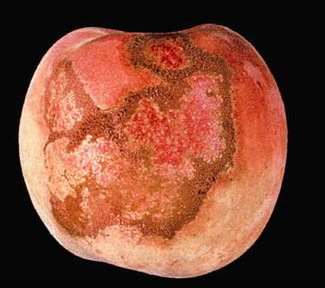Συμπτώματα μηλιά (5/5) Στουσ καρποφσ, φςτερα από πρϊιμεσ προςβολζσ δθμιουργείται παραμόρφωςθ του καρποφ.