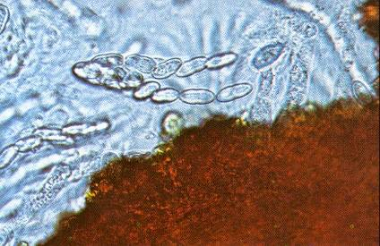 Nectria galligena (εξέλκωση βραχιόνων οπωροφόρων) Αγενή