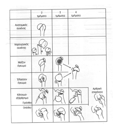 συνεπώς της αιµάτωσης) της έσω επιφάνειας του ανατοµικού αυχένα του βραχιονίου. Σχήµα 9. Ταξινόµηση των Καταγµάτων της Κεφαλής του Βραχιονίου Κατά Neer 47,74,88 Η οµάδα της Α.Ο.