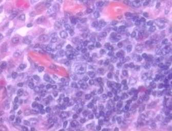 Παραφλοιός μικρά Τ λεμφοκύτταρα και βλαστικές μορφές (Τ ανοσοβλάστες), που ενεργοποιούν τα Β λεμφοκύτταρα, Φλεβίδια με υψηλό ενδοθήλιο (high