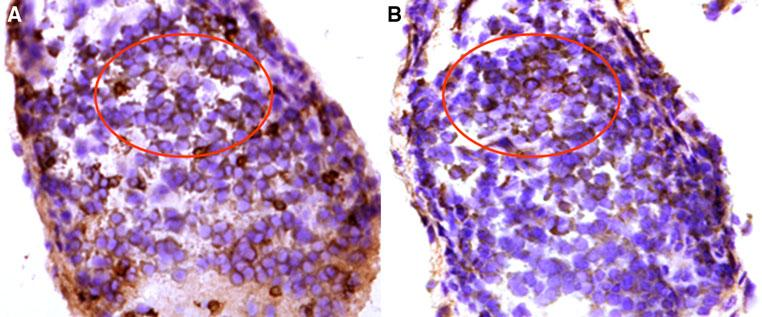 Synovial tissue of psoriatic arthritis is enriched