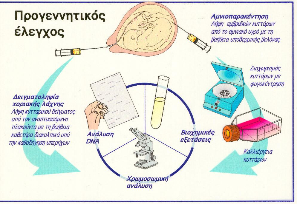 «Τεχνικές» προγεννητικού ελέγχου σε