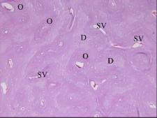 επιμήκης διατομή τένοντα Λιπώδης ιστός Ο χόνδρινος ιστός είναι στερεός και συγχρόνως εύκαμπτος. Τα κύτταρά του, οι χονδροβλάστες, βρίσκονται μέσα σε κοιλότητες της μεσοκυττάριας ουσίας.