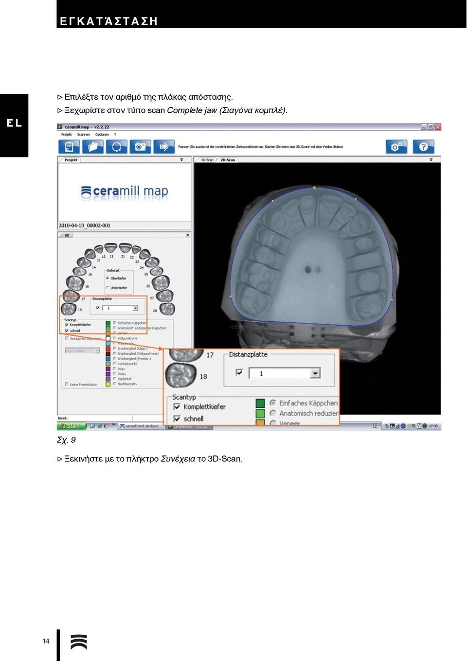 Ξεχωρίστε στον τύπο scan Complete jaw