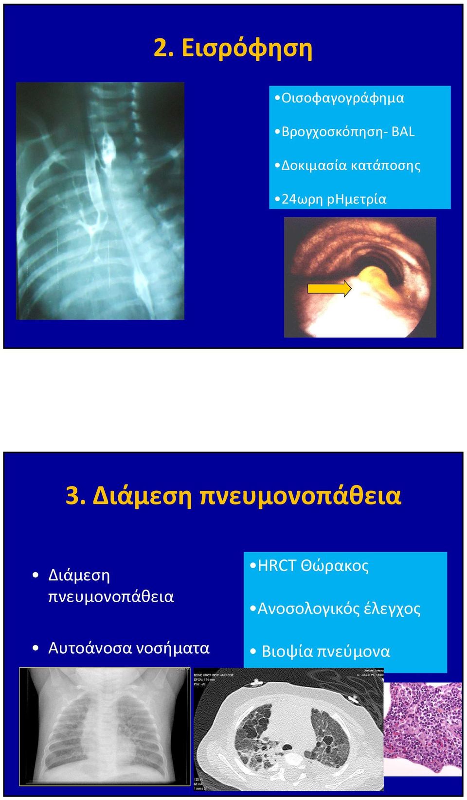 Οισοφαγογράφημα Βρογχοσκόπηση- BAL Δοκιμασία κατάποσης 24ωρη phμετρία 3.