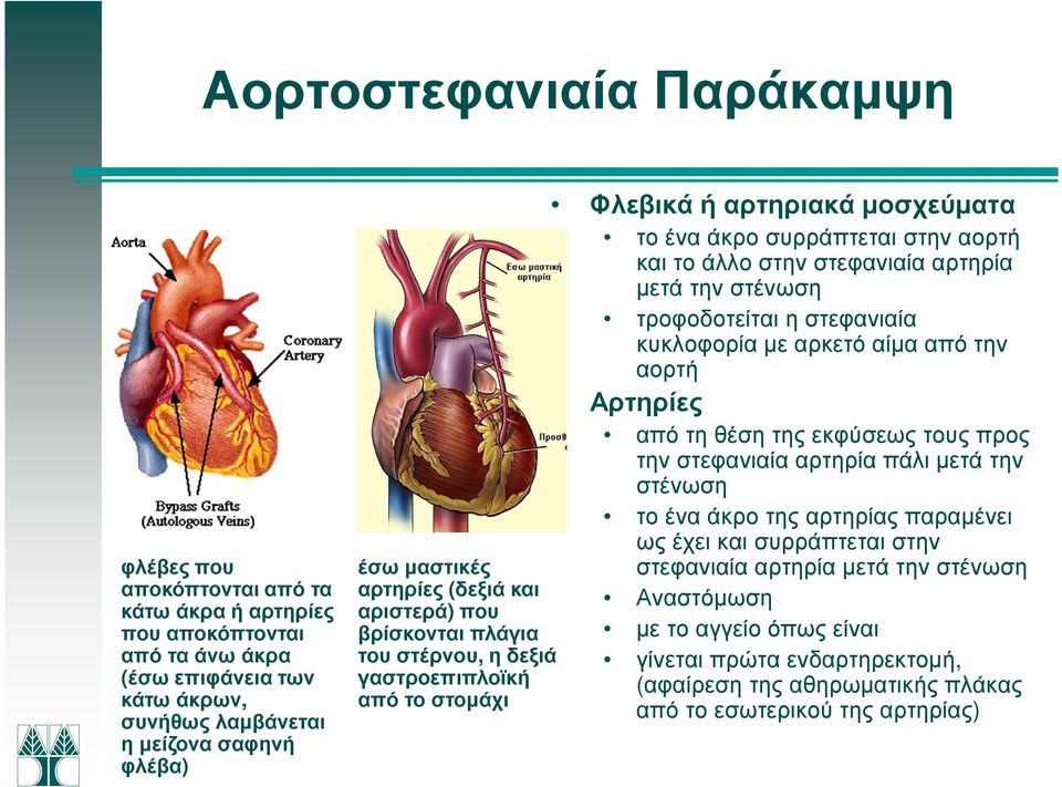 αρτηρία µετά την στένωση τροφοδοτείται η στεφανιαία κυκλοφορία µε αρκετό αίµα από την αορτή Αρτηρίες από τη θέση της εκφύσεως τους προς την στεφανιαία αρτηρία πάλι µετά την στένωση το ένα άκρο της