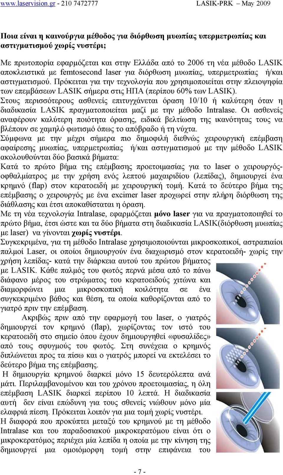 Πρόκειται για την τεχνολογία που χρησιµοποιείται στην πλειοψηφία των επεµβάσεων LASIK σήµερα στις ΗΠΑ (περίπου 60% των LASIK).