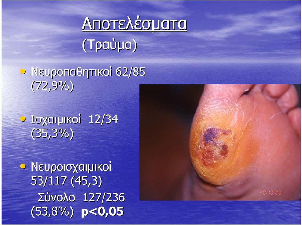 Ισχαιμικοί 12/34 (35,3%)