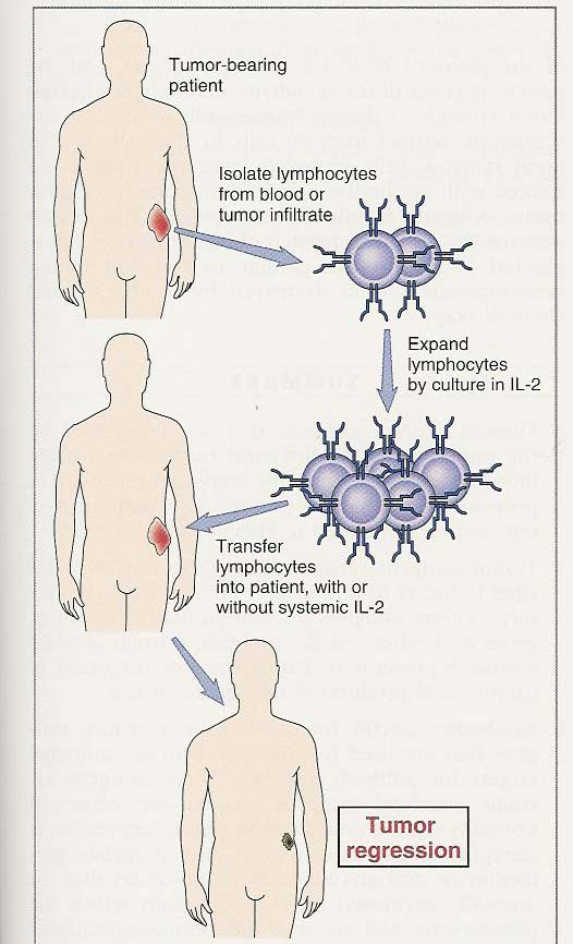 Θετή κυτταρική ανοσοθεραπεία Τ κύτταρα ασθενούς in vitro