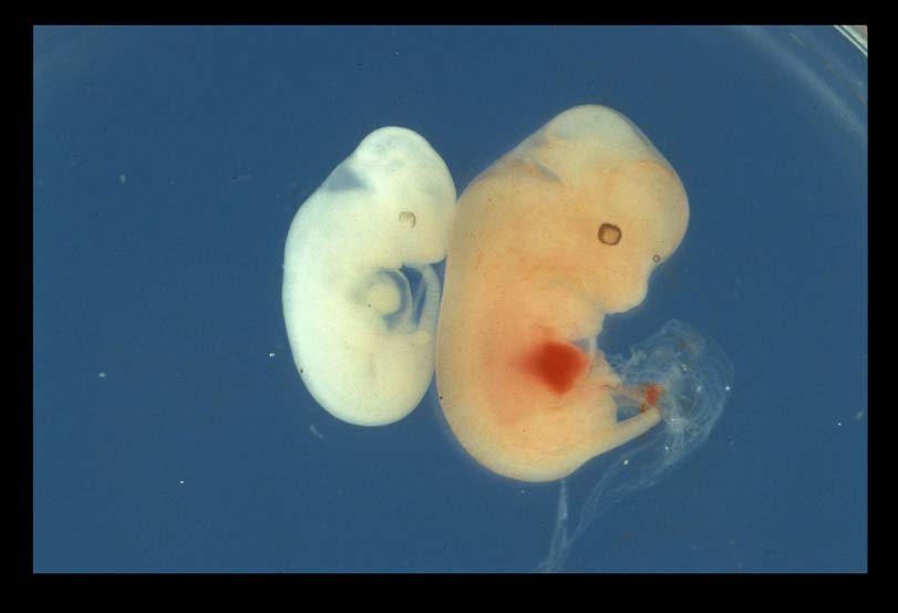 Α Β Εικόνα 3. Οπτική σύγκριση διαγονιδιακών (αριστερά) και φυσιολογικών (δεξιά) εμβρύων. (A) Εμβρυϊκή ημέρα 10.5 