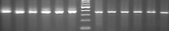 Α 385bp rrna FKLF1 KLF11 362bp Β rrna + FKLF1 Γ rrna + + φ κ φ κ φ κ φ κ φ κ FKLF1 Εικόνα 6. RT-PCR για ανίχνευση του FKLF1 σε ανθρώπινο περιφερικό αίμα, μυελό οστών και πνευμονικό ιστό. Α.