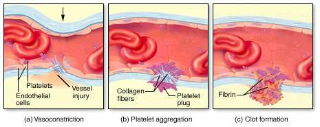 Αιμόσταση Αγγειοσύσπαση Ενεργοποίηση, συσσώρευση και προσκόλληση των αιμοπεταλίων (PLT) στο τραυματισμένο ενδοθήλιο και δημιουργία του αιμοπεταλιακού θρόμβου Ενεργοποίηση του μηχανισμού πήξης και