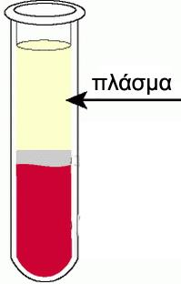 ΣΥΓΚΡΙΣΗ ΕΡΓΑΣΤΗΡΙΟΥ ΚΑΙ ΣΑΚΧΑΡΟΜΕΤΡΗΤΩΝ Το εργαστήριο μετρά στο πλάσμα του αίματος Τα σακχαρόμετρα μετρούν στο ολικό τριχοειδικό αίμα Για να είναι συγκρίσιμες οι μετρήσεις, διαιρείται η μέτρηση του