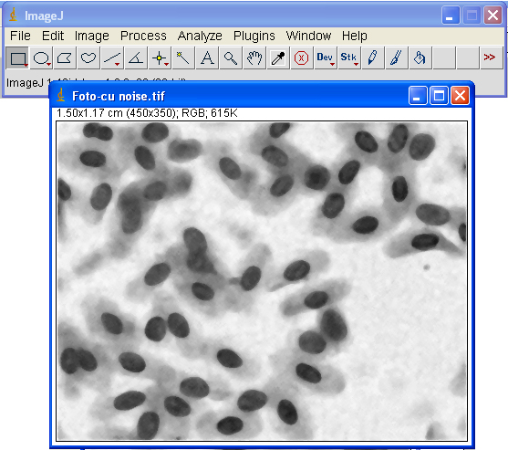 1. Se deschide o imagine care prezintă zgomot (observaţi aspectul acesteia). 2. Comanda de filtrare a unei imagini: Process -> Filters -> Median. 3.