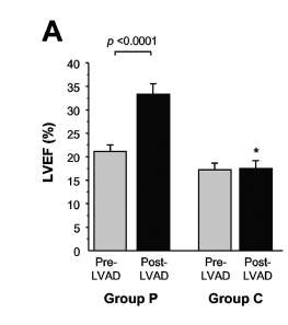 Effects of Left ventricular ejection fraction (LVEF) pulsatile-flow and continues-flow