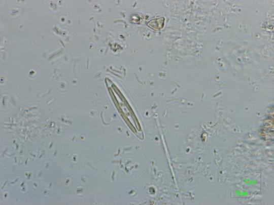 Detonula (Φώτο: Κ. Βαλαβάνης) Diatoma (Φώτο: Κ. Βαλαβάνης) Hemiauallus (Φώτο: Κ.