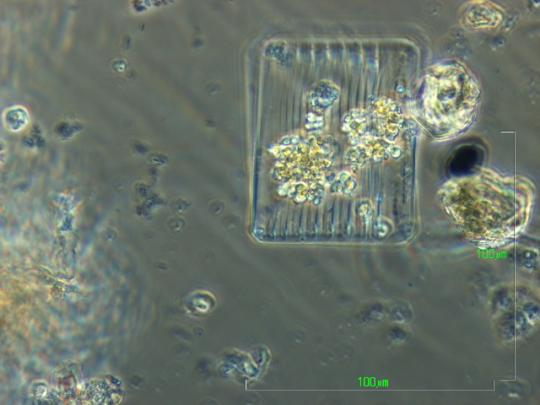 Nitschia (Φώτο: Κ. Βαλαβάνης) Odontella (Φώτο: Κ. Βαλαβάνης) Pleurosigma (Φώτο: Κ.