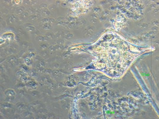 Cotius (Φώτο: Κ. Βαλαβάνης) Dinophysis (Φώτο: Κ. Βαλαβάνης) Dissodinium (Φώτο: Κ. Βαλαβάνης) Gyrodinium (Φώτο: Κ. Βαλαβάνης) Prorocentrum (Φώτο: Κ. Βαλαβάνης) Protoperidinium (Φώτο: Κ.