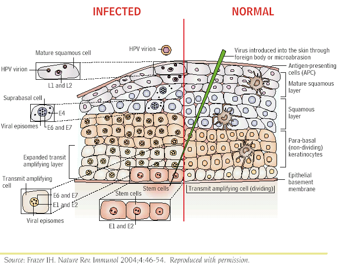 STD disease Ανθεκτικός στη θερμότητα και τη ξηρασία Ζώνη μεταπλάσεως (transformation zone) μεταξύ πλακώδους και κυλινδρικού επιθηλίου α) δραματική ενίσχυση του